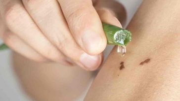 10 Incredible Benefits of Aloe Vera for Skin