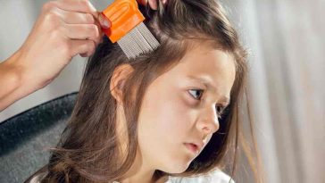 5 Effective Methods to Get Rid of Head Lice and Nits for Good