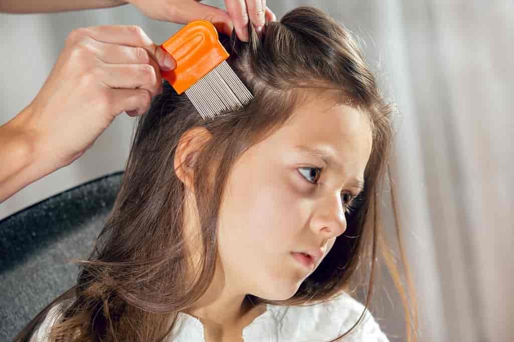 5 Effective Methods to Get Rid of Head Lice and Nits for Good